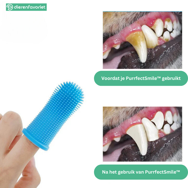 PurrfectSmile™ | Siliconen Vingertandenborstel voor Schonere Tanden en Frisse Adem